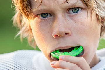 Protective Mouth Guards